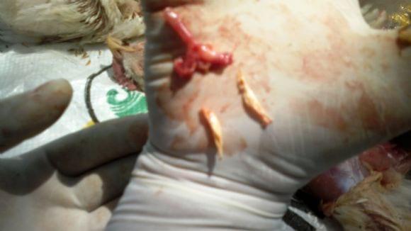 Tracheal choke