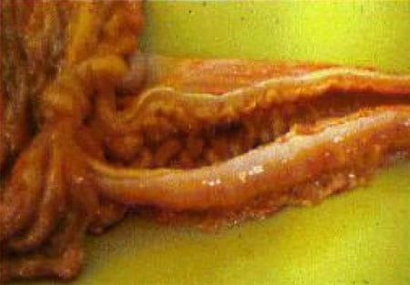 Porcine Intestinal Adenomatosus (Pig Ileitis) - Image 3