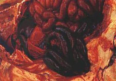 Porcine Intestinal Adenomatosus (Pig Ileitis) - Image 4