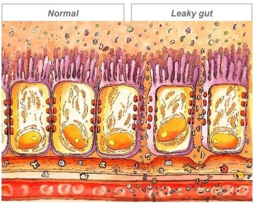 “Leaky Gut Syndrome”: The story behind a bad performance - Image 1