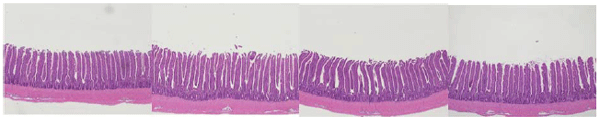Figure 2 - Histology showing greater development of villus and greater villus height to crypt depth ratio