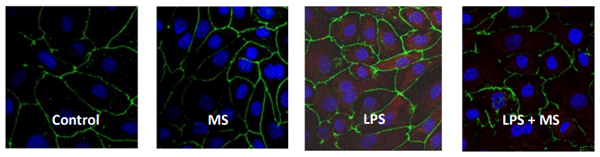 Figure 1 - Immunofluorescence of NF-kB (P-p65) in IPEC-J2 cells treated for 4 h either with and without an LPS challenge and with and without an anti-mycotoxin product. Red: p-p65-TRITC (Tetramethylrhodamine). Green: occludin-FITC (Fluorescein-5-isothiocyanate). Blue: nucleiDAPI (4
