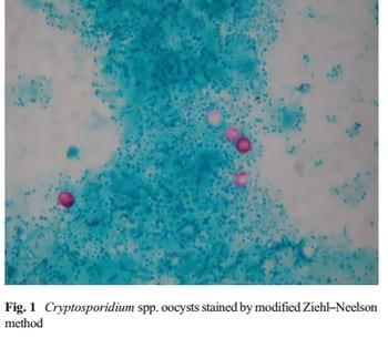 Prevalence of Cryptosporidium Spp. Infection in some Dairy Herds of Mashhad (Iran) and its Association with Diarrhea in Newborn Calves - Image 3