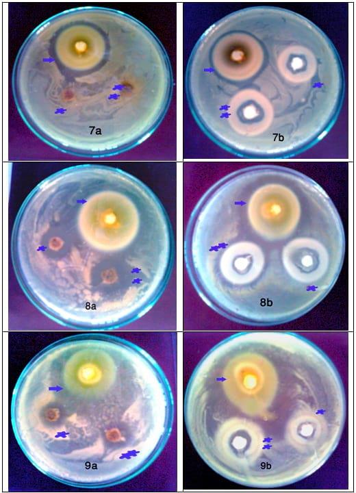 An In Vitro Study on the Effect of some Pre and Probiotics on some pathogenic Bacteria - Image 4