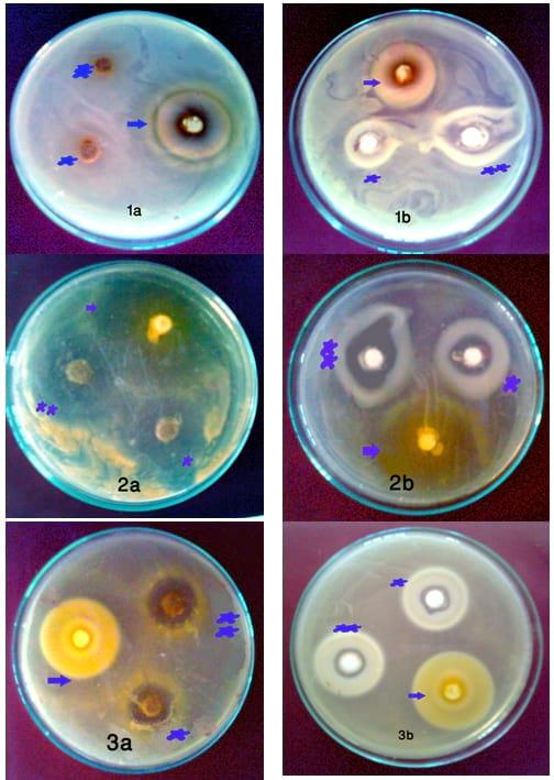 An In Vitro Study on the Effect of some Pre and Probiotics on some pathogenic Bacteria - Image 2