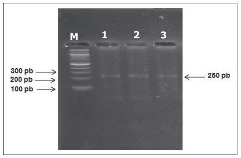 Molecular Characterization of Local Isolates of Infectious Bursal Disease Virus from Broiler Chickens in Iraq - Image 1