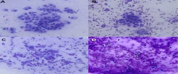 A novel cytologic sampling technique to diagnose subclinical endometritis and comparison of staining methods for endometrial cytology samples in dairy cows - Image 6