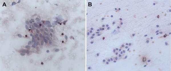 A novel cytologic sampling technique to diagnose subclinical endometritis and comparison of staining methods for endometrial cytology samples in dairy cows - Image 8
