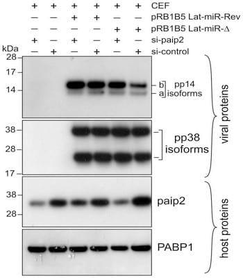Poly(A) Binding Protein 1 Enhances Cap-Independent Translation Initiation of Neurovirulence Factor from Avian Herpesvirus - Image 7
