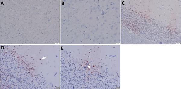 Pathogenicity of Highly Pathogenic Avian Influenza Virus H5N1 in Naturally Infected Poultry in Egypt - Image 6