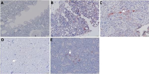 Pathogenicity of Highly Pathogenic Avian Influenza Virus H5N1 in Naturally Infected Poultry in Egypt - Image 9