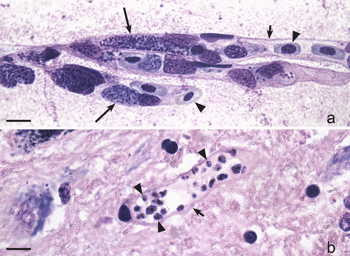 Exo-erythrocytic development of avian malaria and related haemosporidian parasites - Image 5
