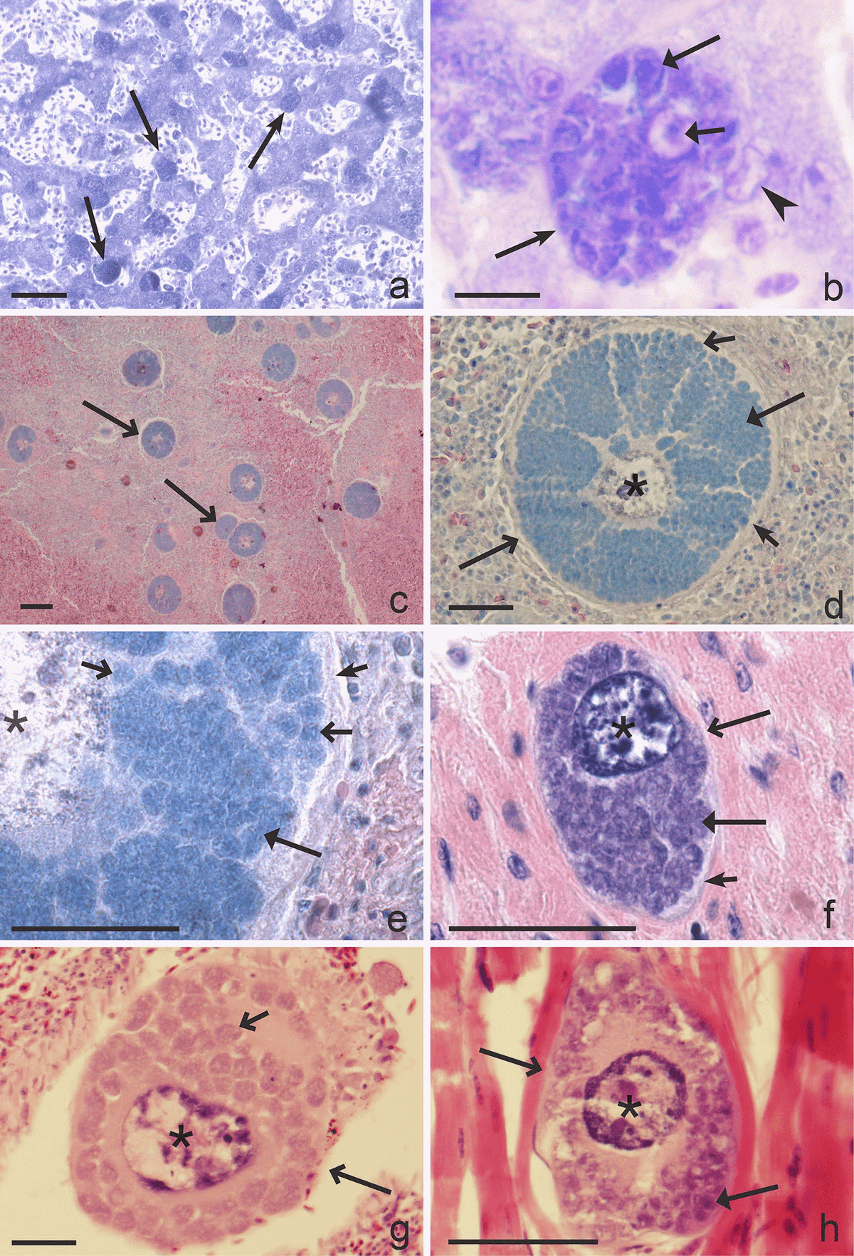 Exo-erythrocytic development of avian malaria and related haemosporidian parasites - Image 11