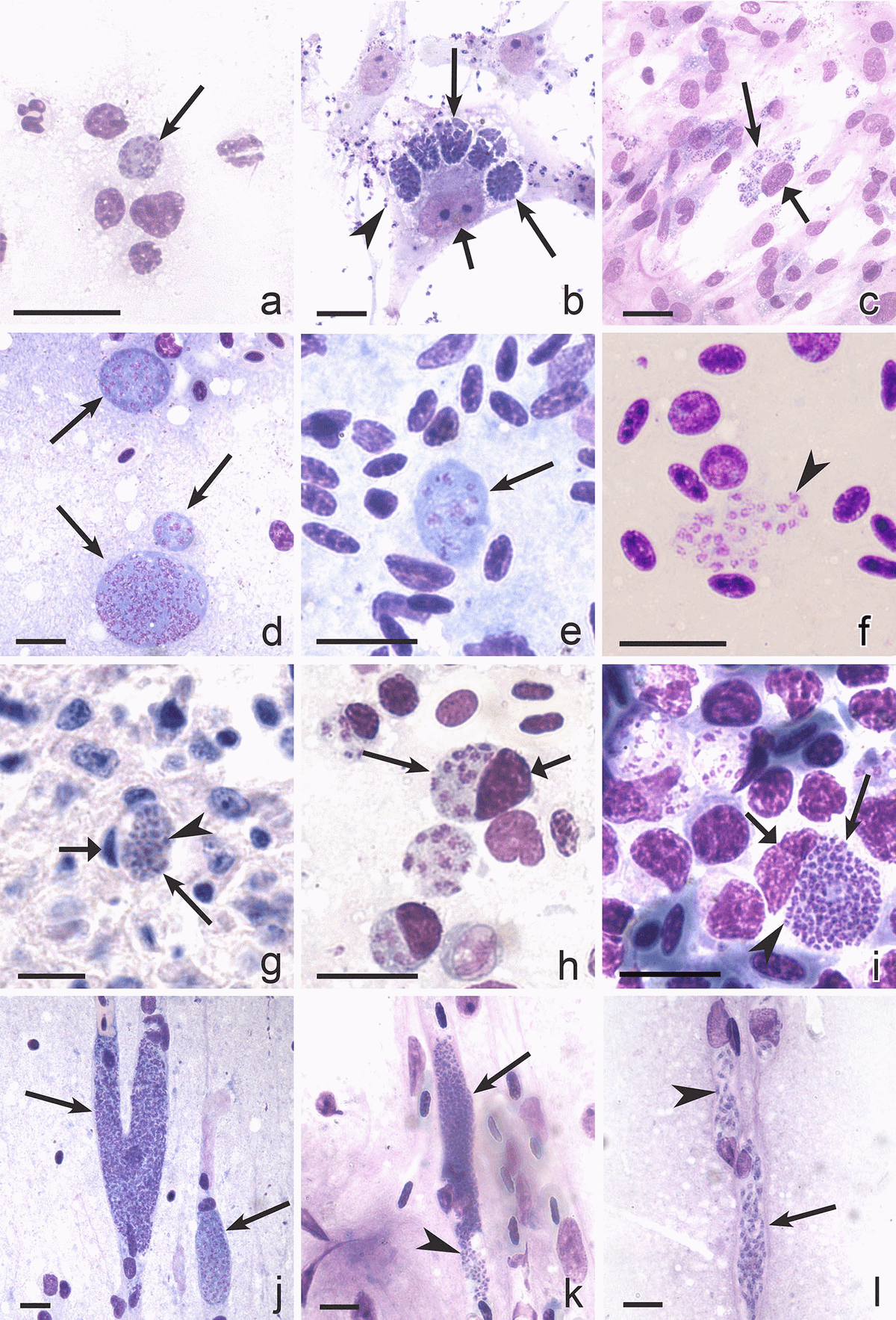 Exo-erythrocytic development of avian malaria and related haemosporidian parasites - Image 3