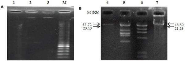 Prophylactic Bacteriophage Administration More Effective than Post-infection Administration in Reducing Salmonella entérica serovar Enteritidis Shedding in Quail - Image 8