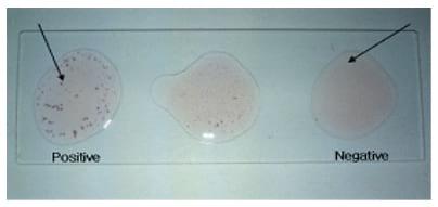 Development of slide micro-agglutination system for the rapid diagnosis of Salmonella infection in the chicken - Image 2