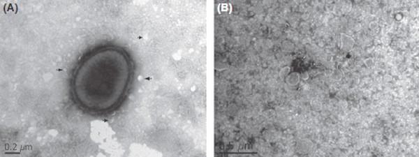 Outer membrane vesicles of Pasteurella multocida contain virulence factors - Image 1