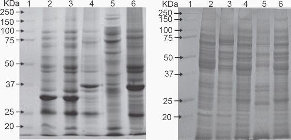 Outer membrane vesicles of Pasteurella multocida contain virulence factors - Image 2