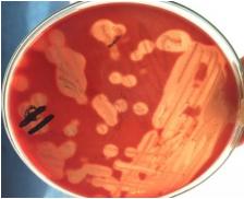 Pathogenicity of Ten Gallibacterium Anatis Isolates in Commercial Broiler Chickens - Image 1