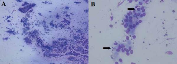 Postpartum uterine diseases in dairy cows: a review with emphasis on subclinical endometritis - Image 4