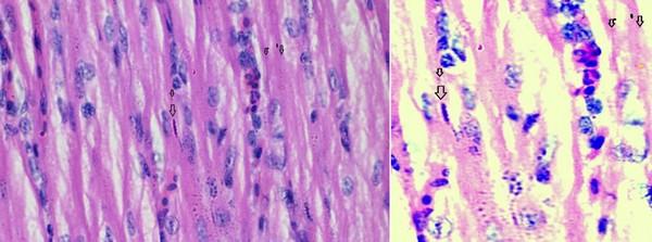 Role of histopathological examination in diagnosis of avian leucosis virus subtype J in broiler chicken in Egypt - Image 12