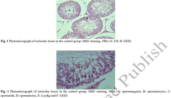 Evaluation of Sperm Parameters, Reproductive Hormones, Histological Criteria, and Testicular Spermatogenesis Using Turnip Leaf (Brassica Rapa) Hydroalcoholic Extract in Male Rats: An Experimental Study - Image 4