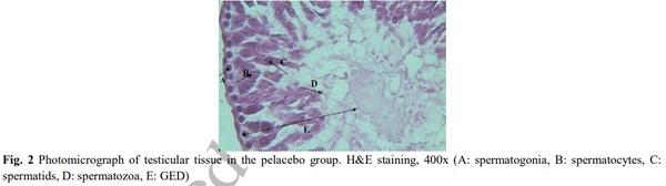 Evaluation of Sperm Parameters, Reproductive Hormones, Histological Criteria, and Testicular Spermatogenesis Using Turnip Leaf (Brassica Rapa) Hydroalcoholic Extract in Male Rats: An Experimental Study - Image 5