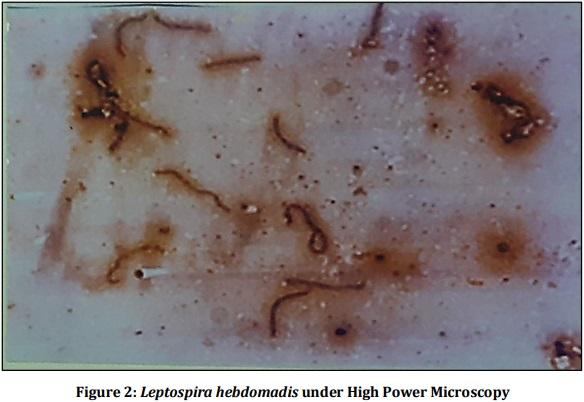 Vaccine Preperative Trial for Leptospirosis and their Pathological, Immunological Study by Serum Electrophoresis - Image 2