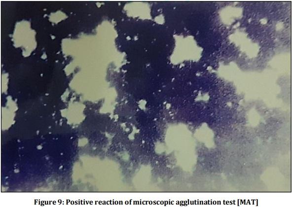 Vaccine Preperative Trial for Leptospirosis and their Pathological, Immunological Study by Serum Electrophoresis - Image 13