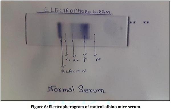 Vaccine Preperative Trial for Leptospirosis and their Pathological, Immunological Study by Serum Electrophoresis - Image 6