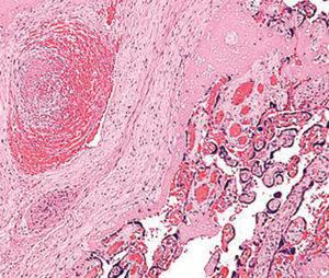 Case study: pathology and histopathology as a tool for diagnosis of reproductive disorders in pigs related to mycotoxins - Image 9