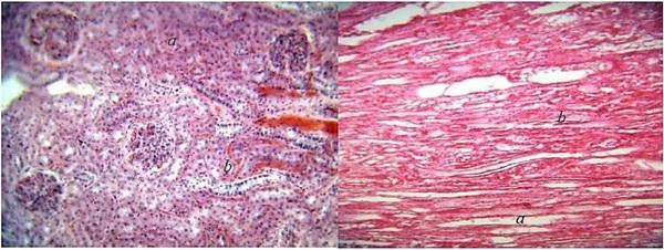 Histopathological changes in pigs infected with ileitis - Image 5