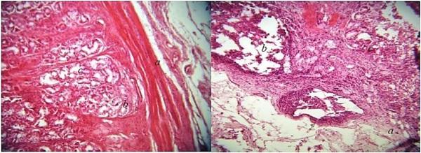 Histopathological changes in pigs infected with ileitis - Image 7