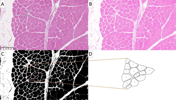 Figure 2. Processing of breast muscle micrographs from 42 d old Ross 308 broilers generated from ImageJ: Original image x10 resolution (A), Eosin stain (pink) image (B), binary mask (C), analyzed particles (D). Analyses provided mean muscle fiber area (mm2 ).