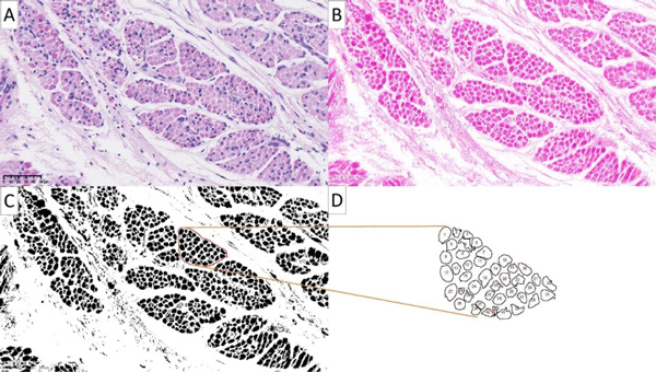 Figure 1. Processing of breast muscle micrographs from Ross 308 chicks at hatch generated from ImageJ: Original image x40 resolution (A), Eosin stain (pink) image (B), binary mask (C), analyzed particles (D). Analyses provided mean muscle fiber area (mm2 ) and number of fibers per mm2 .