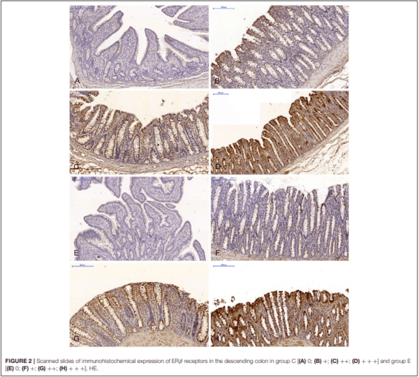 The Effect of 42-Day Exposure to a Low Deoxynivalenol Dose on the Immunohistochemical Expression of Intestinal ERs and the Activation of CYP1A1 and GSTP1 Genes in the Large Intestine of Pre-pubertal Gilts - Image 2