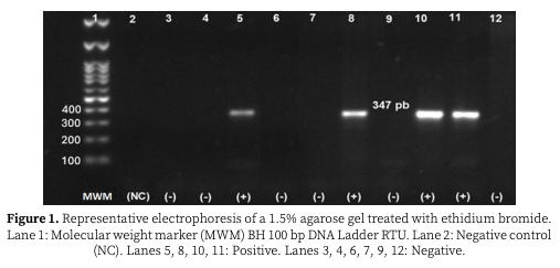 Figure 1. Representative electrophoresis of a 1.5% agarose gel treated with ethidium bromide. Lane 1: Molecular weight marker (MWM) BH 100 bp DNA Ladder RTU. Lane 2: Negative control (NC). Lanes 5, 8, 10, 11: Positive. Lanes 3, 4, 6, 7, 9, 12: Negative.