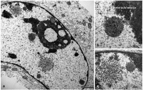 Porcine Circovirus Type 2 Morphogenesis in a Clone Derived from the L35 Lymphoblastoid Cell Line - Image 3