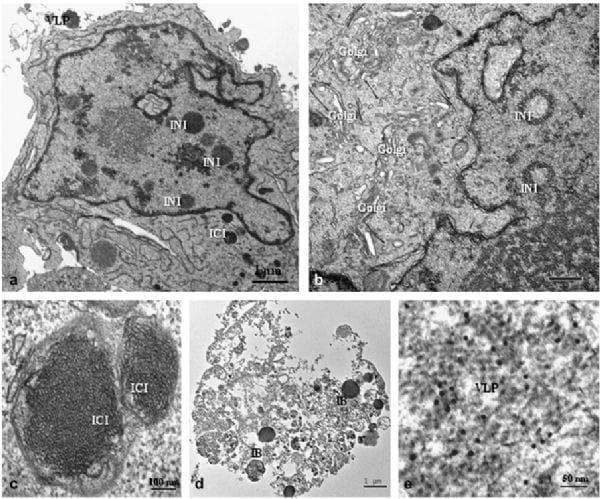 Porcine Circovirus Type 2 Morphogenesis in a Clone Derived from the L35 Lymphoblastoid Cell Line - Image 6