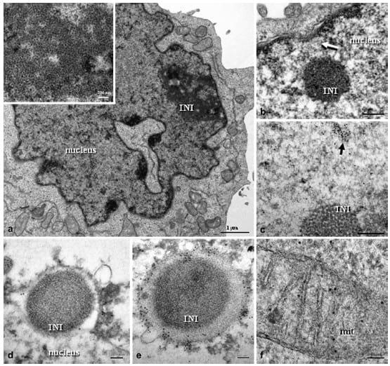 Porcine Circovirus Type 2 Morphogenesis in a Clone Derived from the L35 Lymphoblastoid Cell Line - Image 4