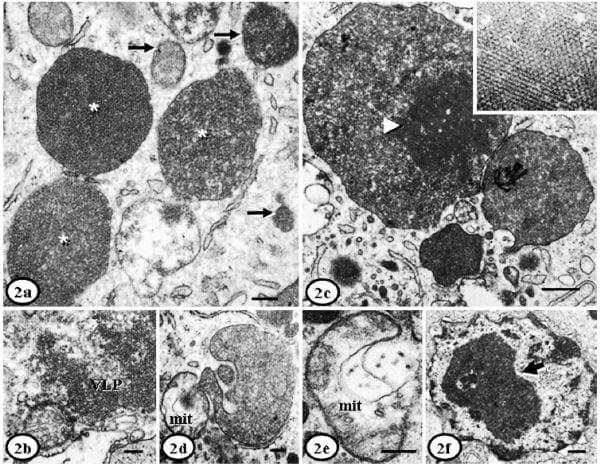 Ultrastructural Findings in Lymph Nodes from Pigs Suffering from Naturally Occurring Postweaning Multisystemic Wasting Syndrome - Image 4