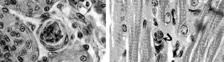 Immunological factors in Black Tiger shrimp, Penaeus monodon, Fabricius - Image 4