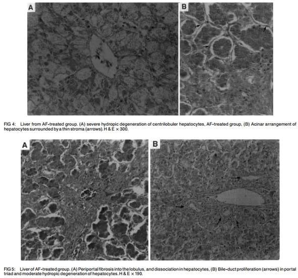 Ameliorative effects of dietary clinoptilolite on pathological changes in broiler chickens during aflatoxicosis - Image 4