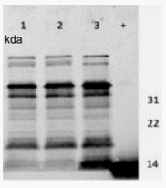 Reduction of Salmonella Enteritidis in the Spleens of Hens by Bacterins That Vary in Fimbrial Protein SefD - Image 5