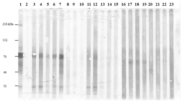 Figure 5. Western analysis demonstrates specificity of recombinant H1 g,m antigen. Positive control sera (lane 1), negative control sera (lane 2), S. Enteritidis challenged specific pathogen free leghorn birds (n = 5) (Samples: 37 9-5, 39 4-5, 40 9-5, 40 8-29, and pooled sera) (lanes 3–7). Sera samples from birds prior to S. Enteritidis challenge (1638, 1636, 1637, 37 8-8, 39 8-8, 1659, 1660, and 1670) (Lanes 8–15), Sera samples collected from S. Enteritidis-culture negative chickens (A, B, C, D, K, L, G, and J) (Lanes 16–23).