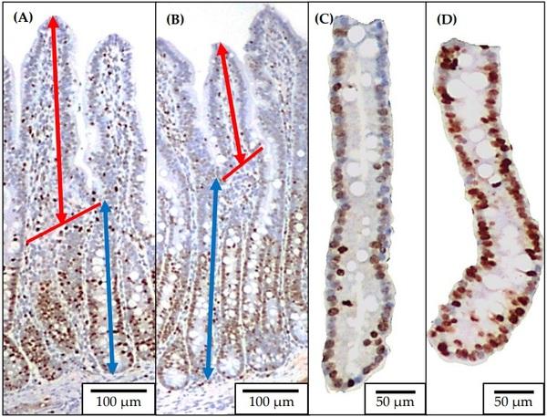 Significance of Mucosa-Associated Microbiota and Its Impacts on Intestinal Health of Pigs Challenged with F18+ E. coli - Image 16