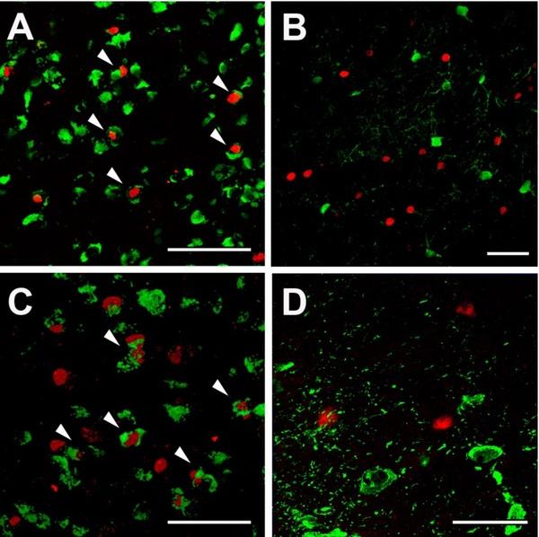 The mycotoxin deoxynivalenol activates GABAergic neurons in the reward system and inhibits feeding and maternal behaviours - Image 8